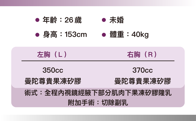 曼陀尊貴(Xtra女王波)隆乳 術後三個月